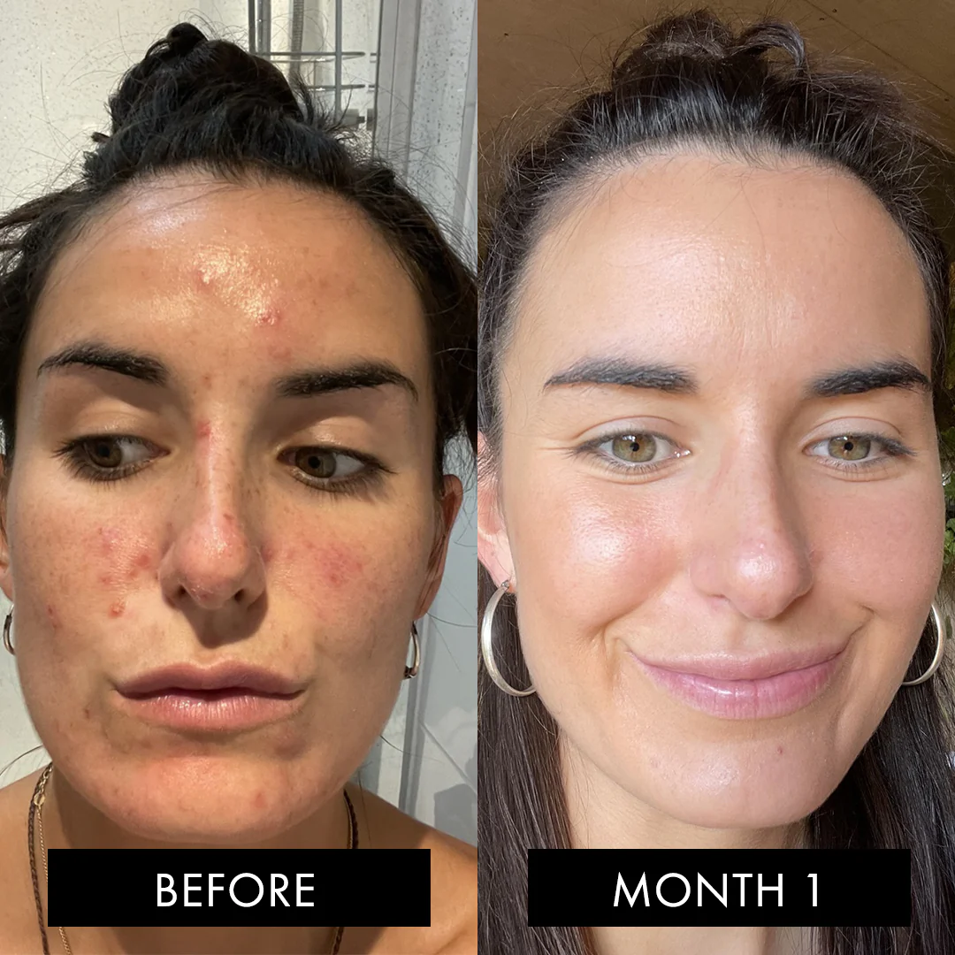 The Skin Elixir - Image 4