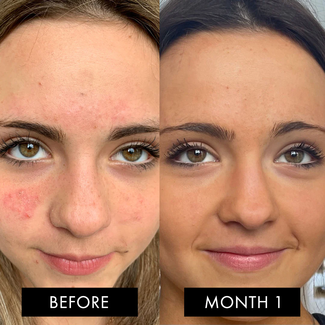 The Skin Elixir Three Month Pack - Image 5