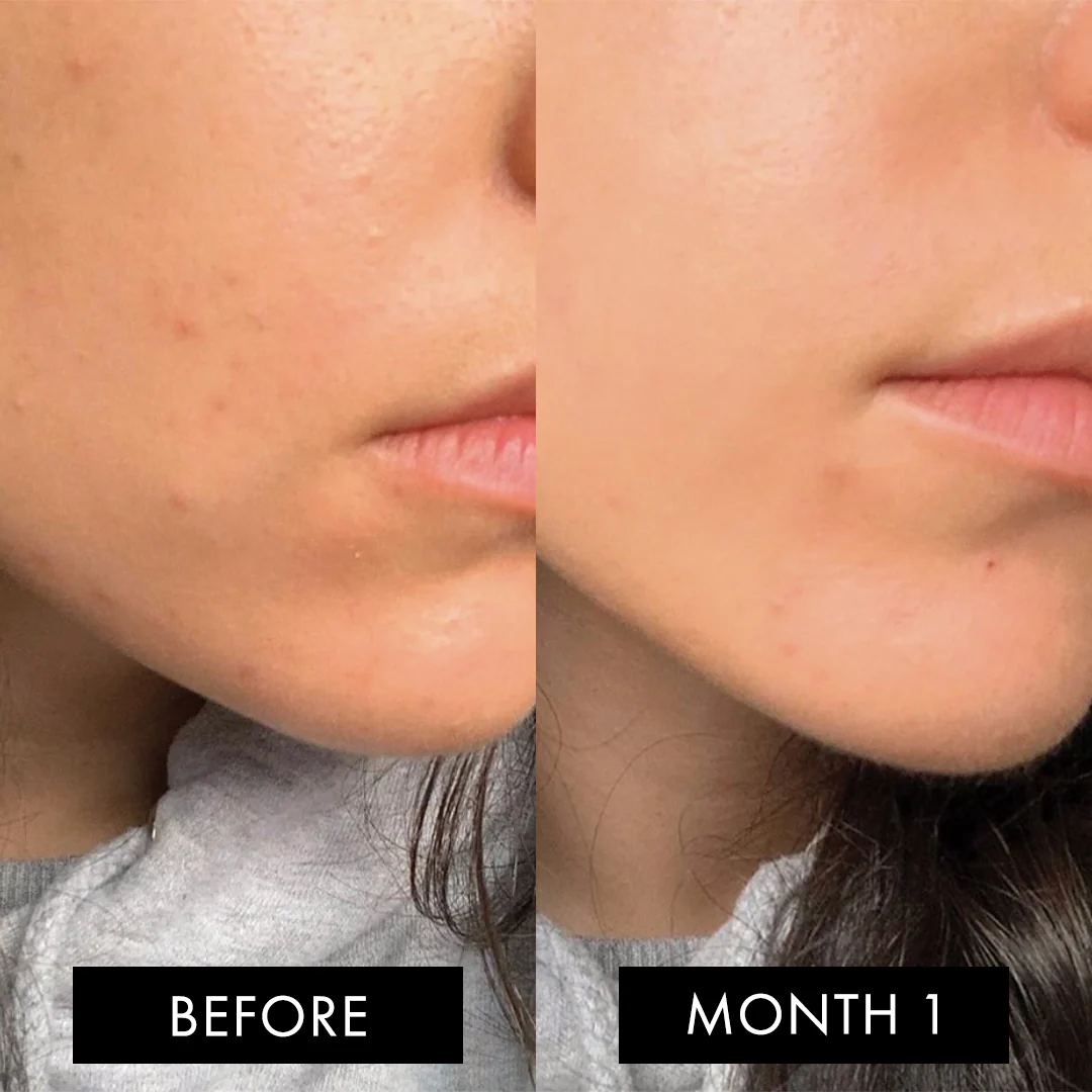 The Skin Elixir Three Month Pack - Image 7